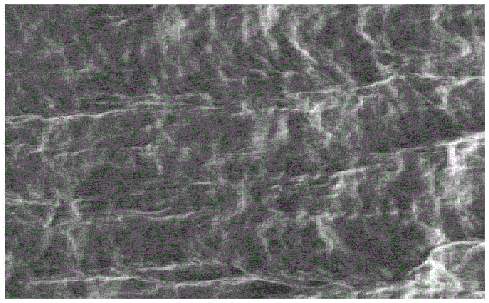 Preparation method of externally constructed tissue engineering trachea matrix