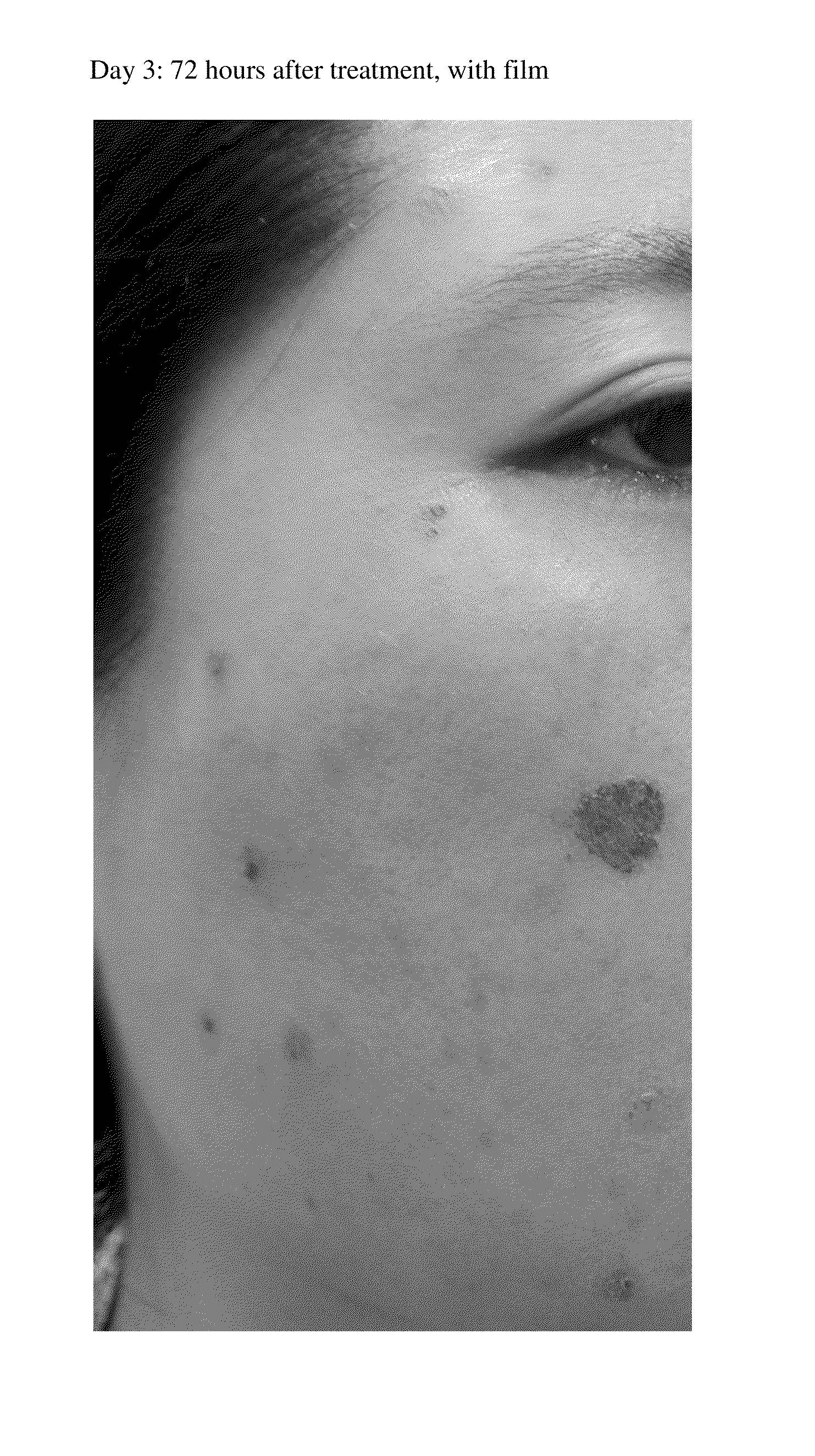 Compositions and methods for treating conditions of compromised skin barrier function