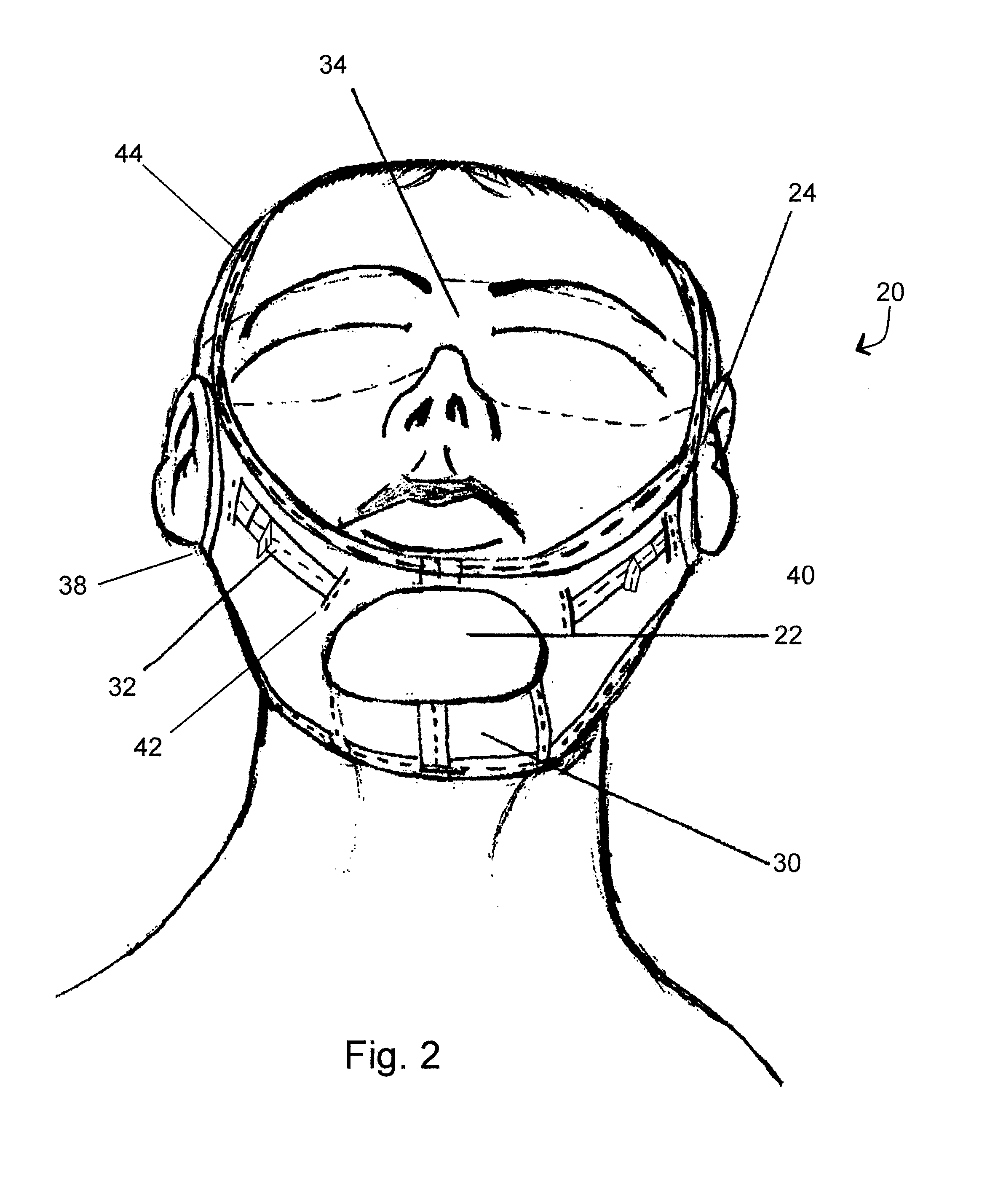 Facial lifting and toning device