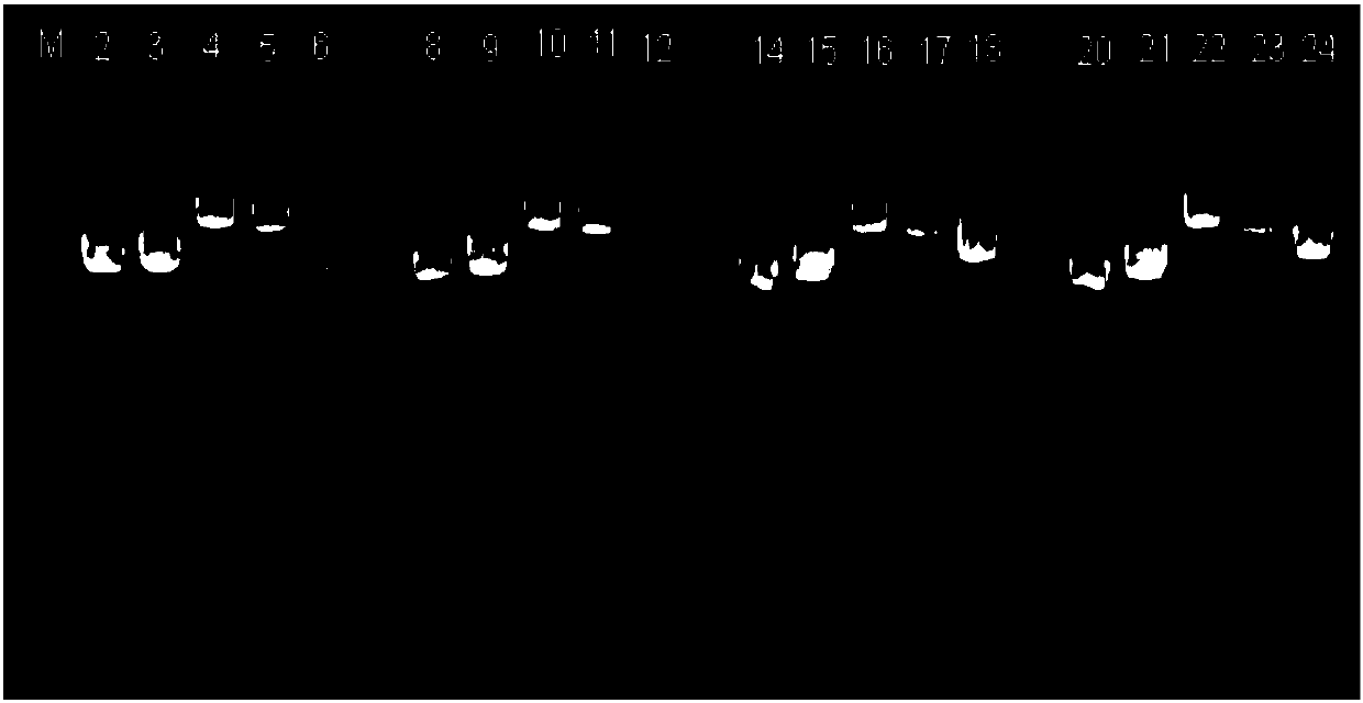 Detection kit and detection method for pkd1 gene mutation