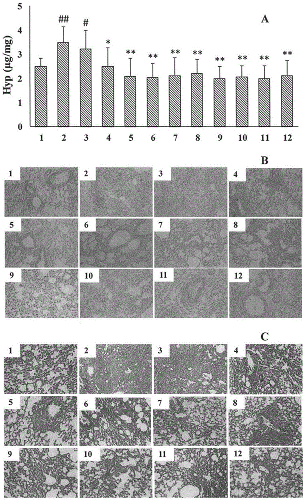 Application of an alkaloid in the preparation of a pharmaceutical composition for preventing or treating pulmonary fibrosis