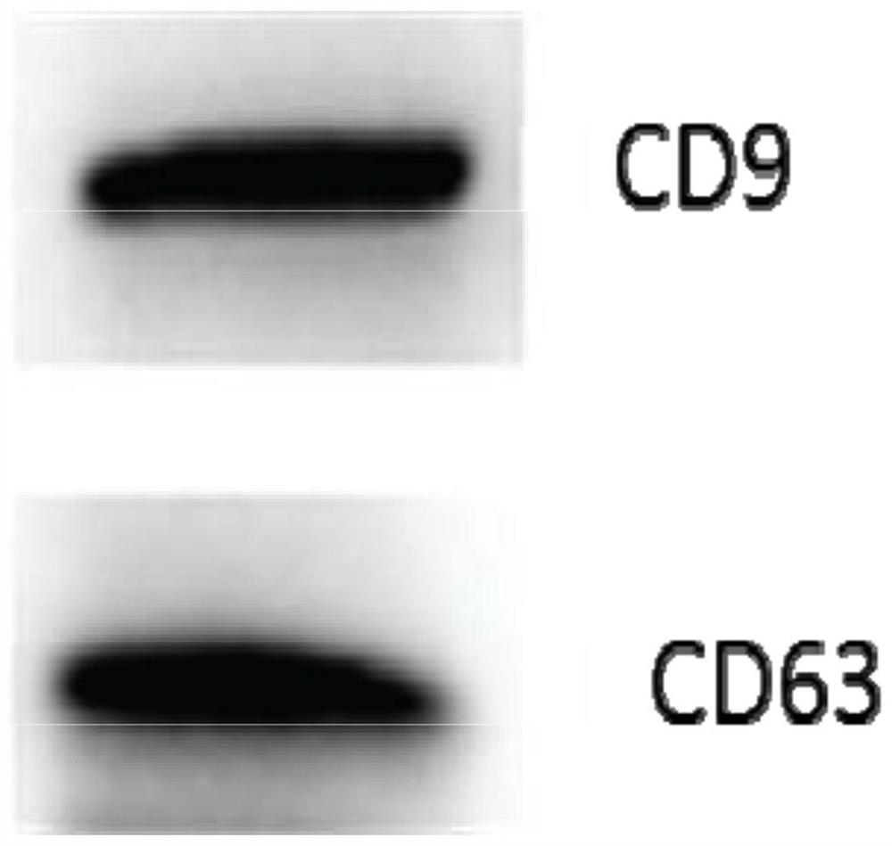 Human pluripotent stem cell exosomes loaded with resveratrol, preparation method and application thereof