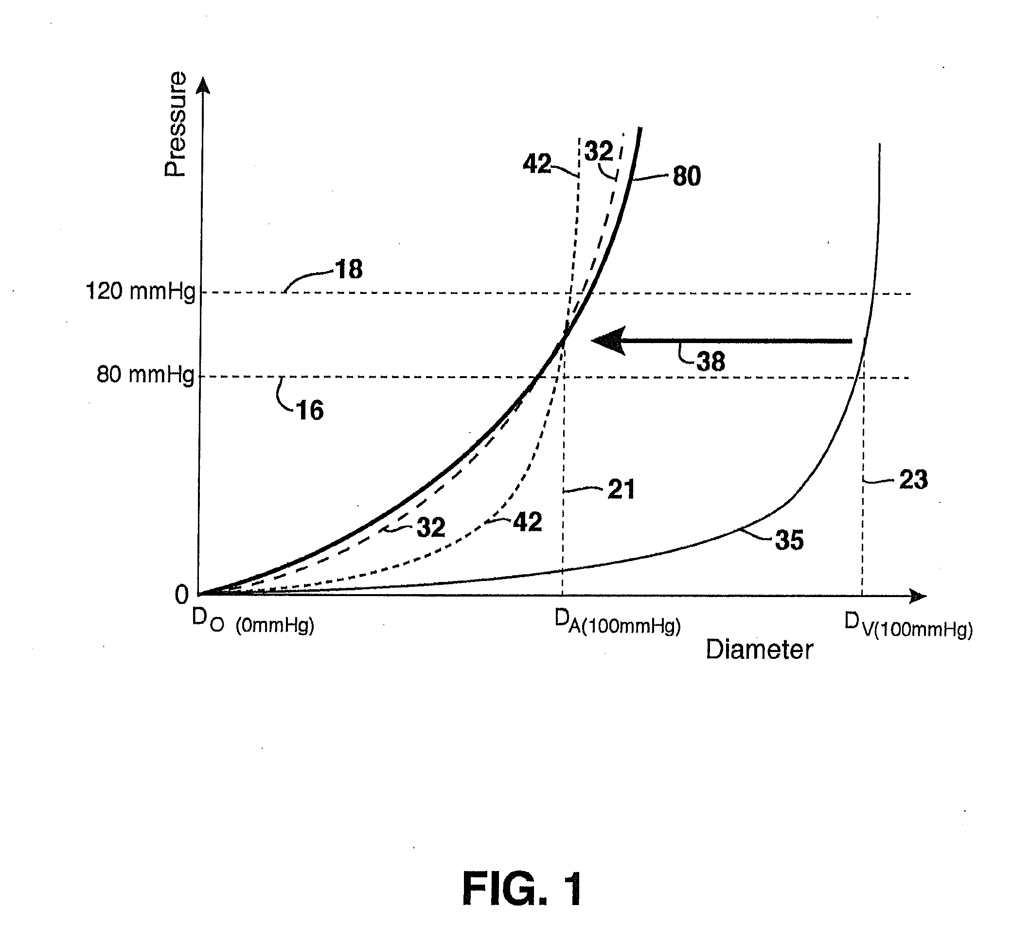 Compliant Venous Graft