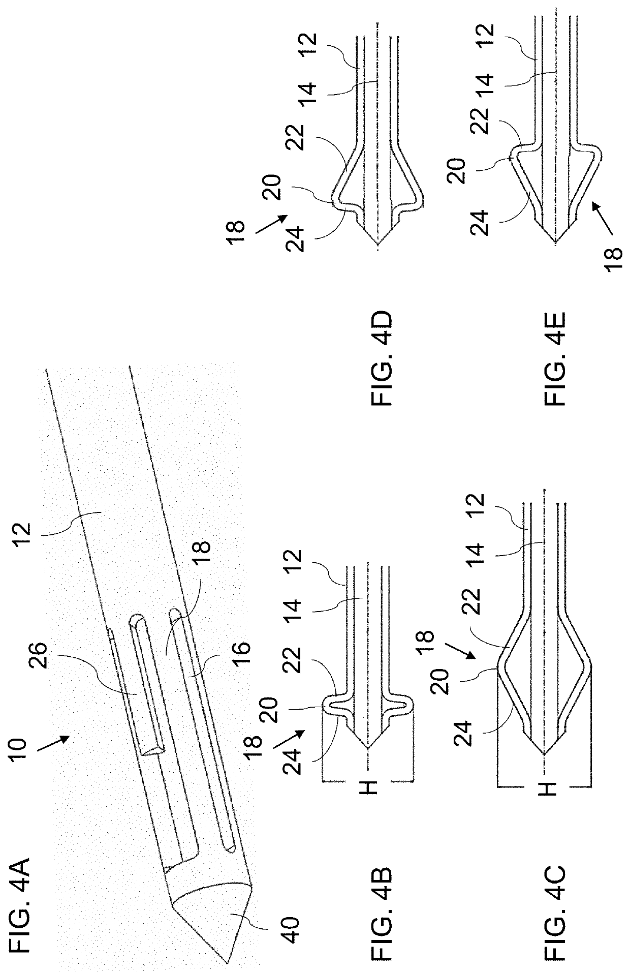 Stiff guide wire with anchoring configuration