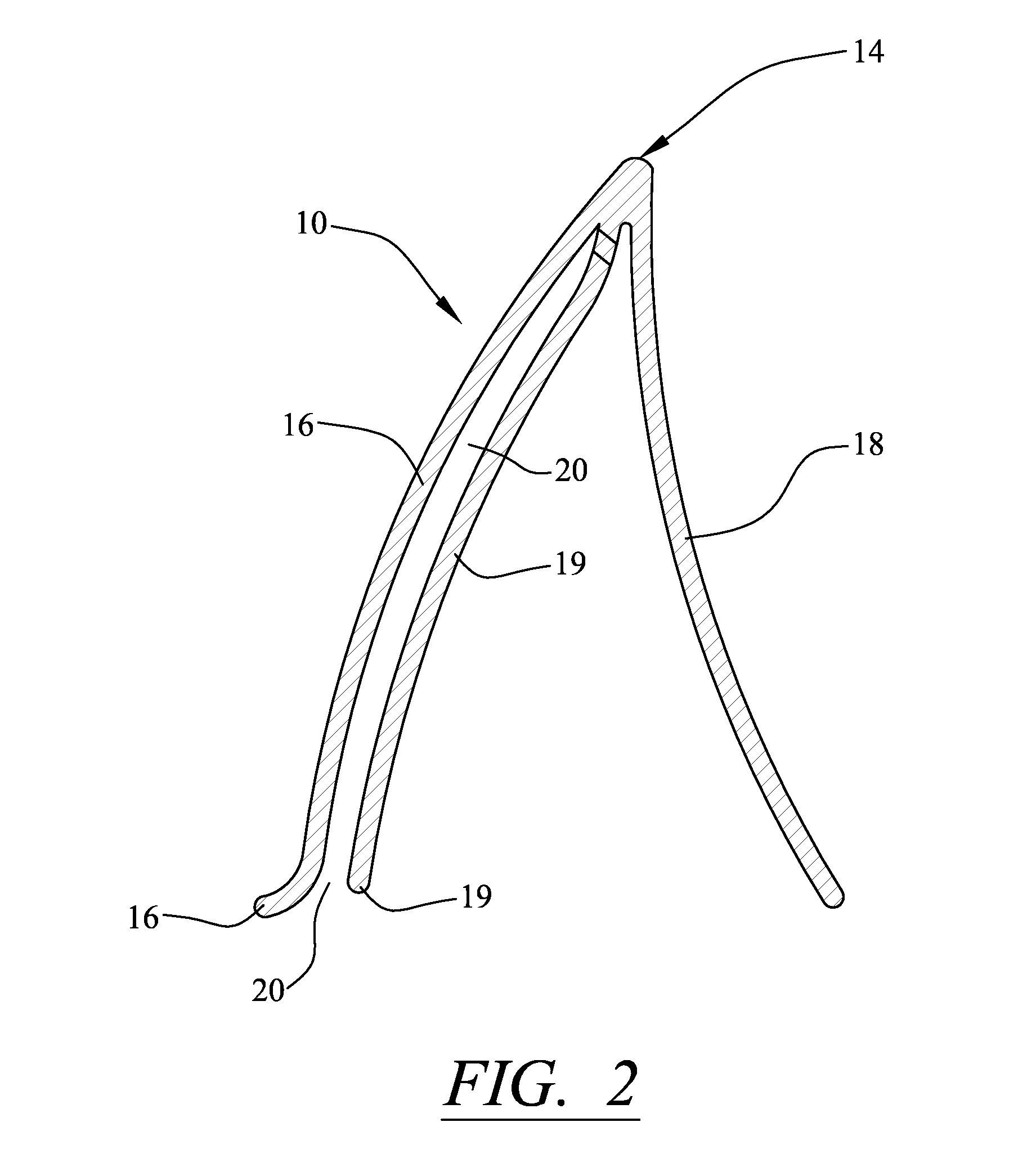 Enhancement to dental alignment device