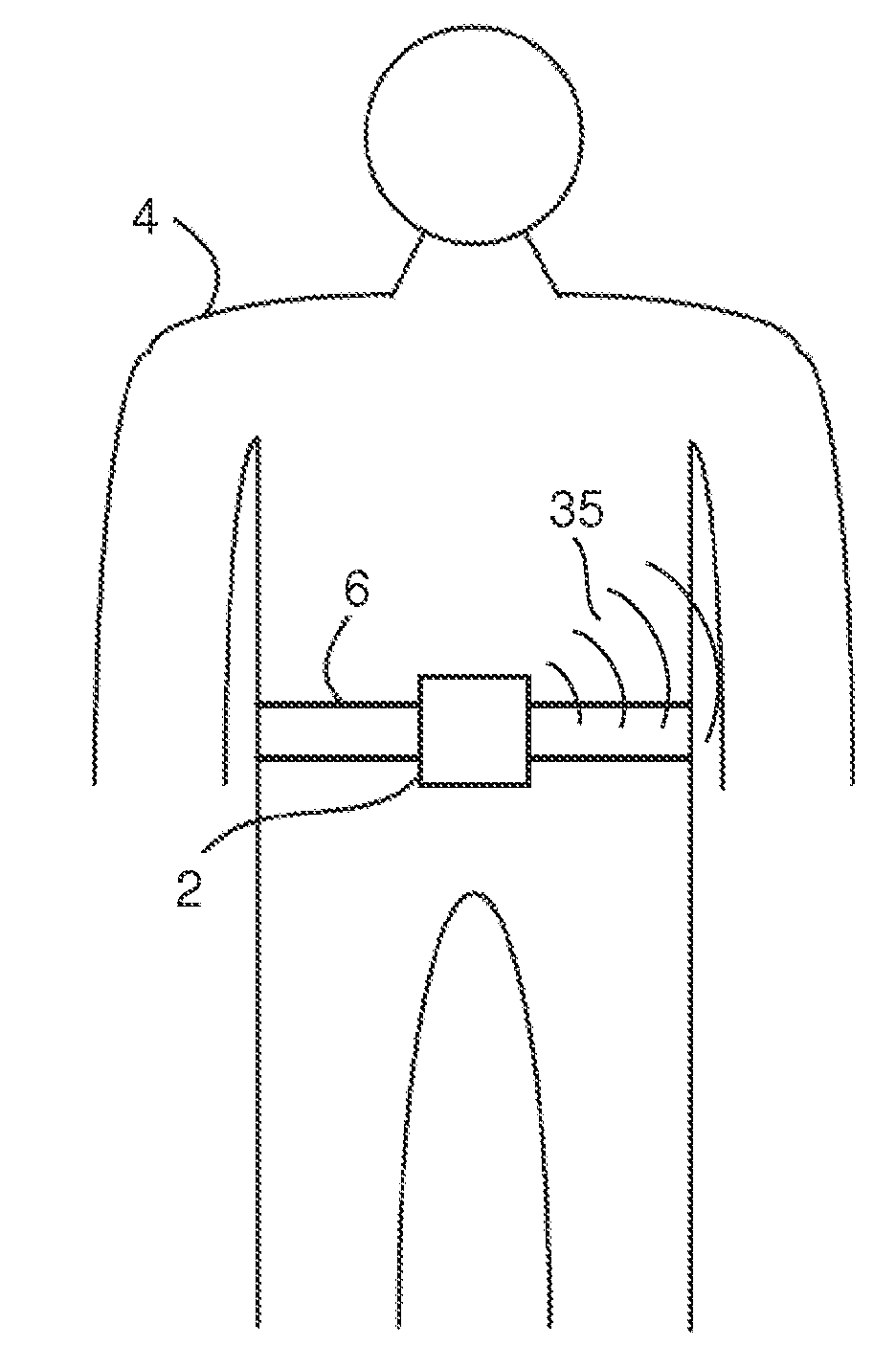  fall detection system and a method of operating a fall detection system