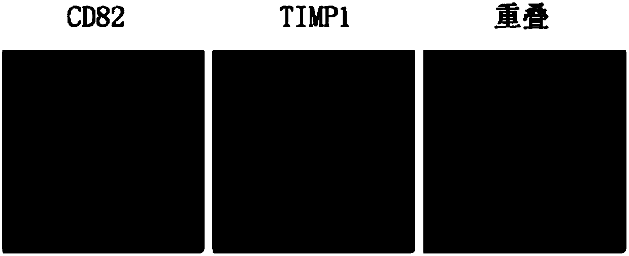 Antibody composition and application thereof for detecting immunohistochemical marker protein combination of pancreatic ductal adenocarcinoma