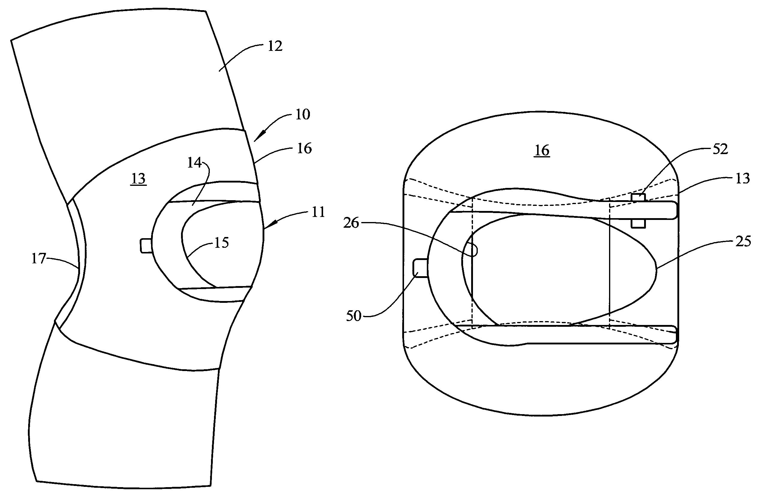 Glide sleeve brace