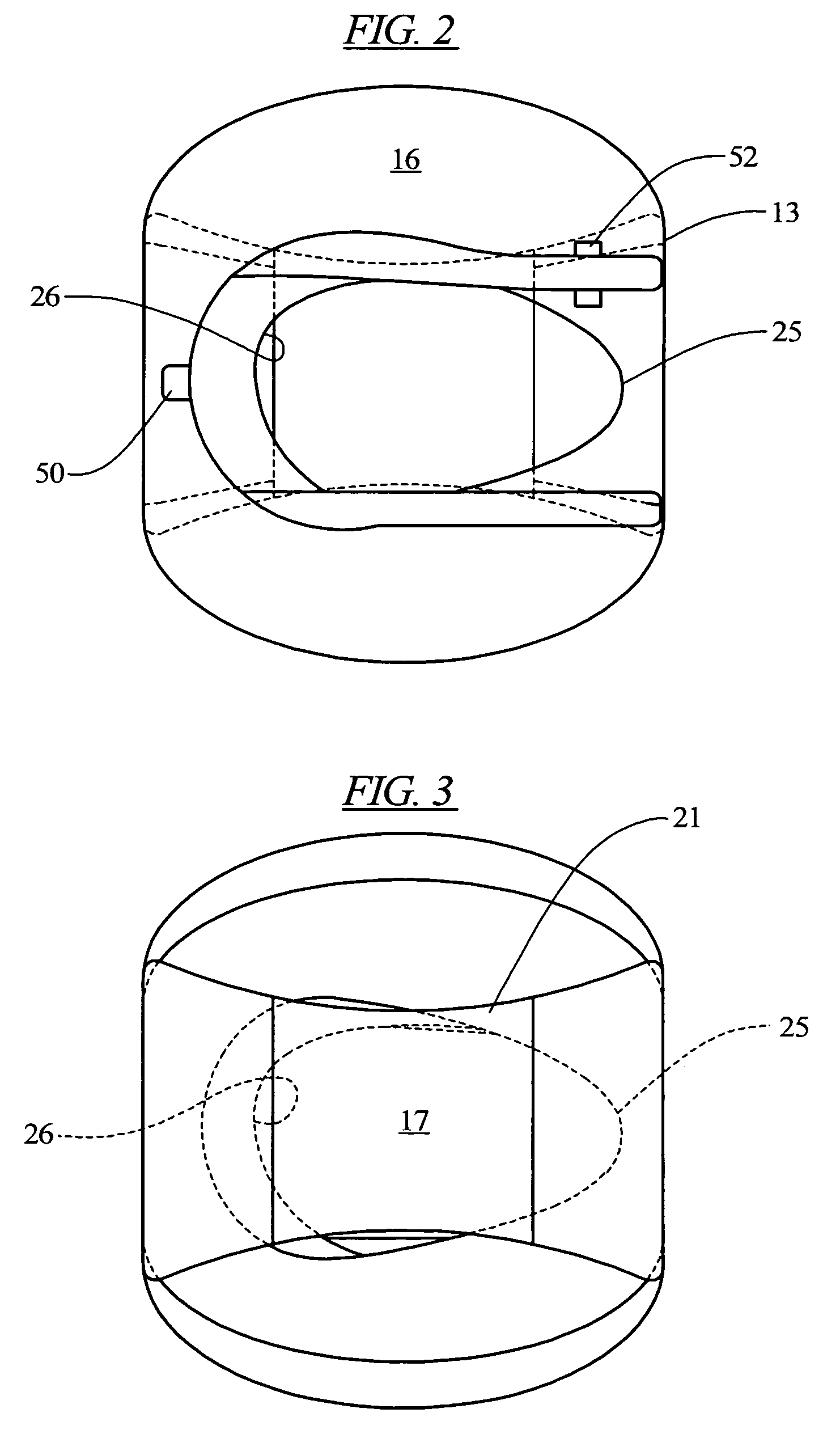 Glide sleeve brace