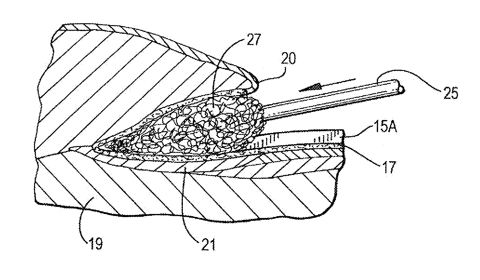 Podiatric system