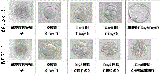 Application of mir-509-3p expression inhibitor in preparation of medicine for treating polycystic ovary syndrome