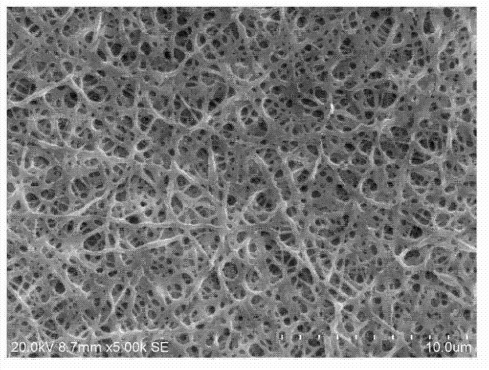 Double-layer electrospinning bionic periosteum and method for preparing same