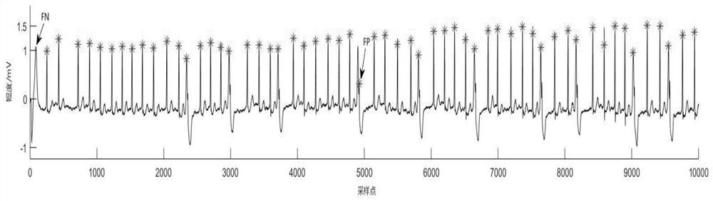 Electrocardiosignal R wave recognition method based on empirical wavelet transform (EWT) and structural feature extraction