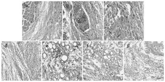 Application of pericarpium citri reticulatae essential oil to preparation of products for preventing or treating arthritis