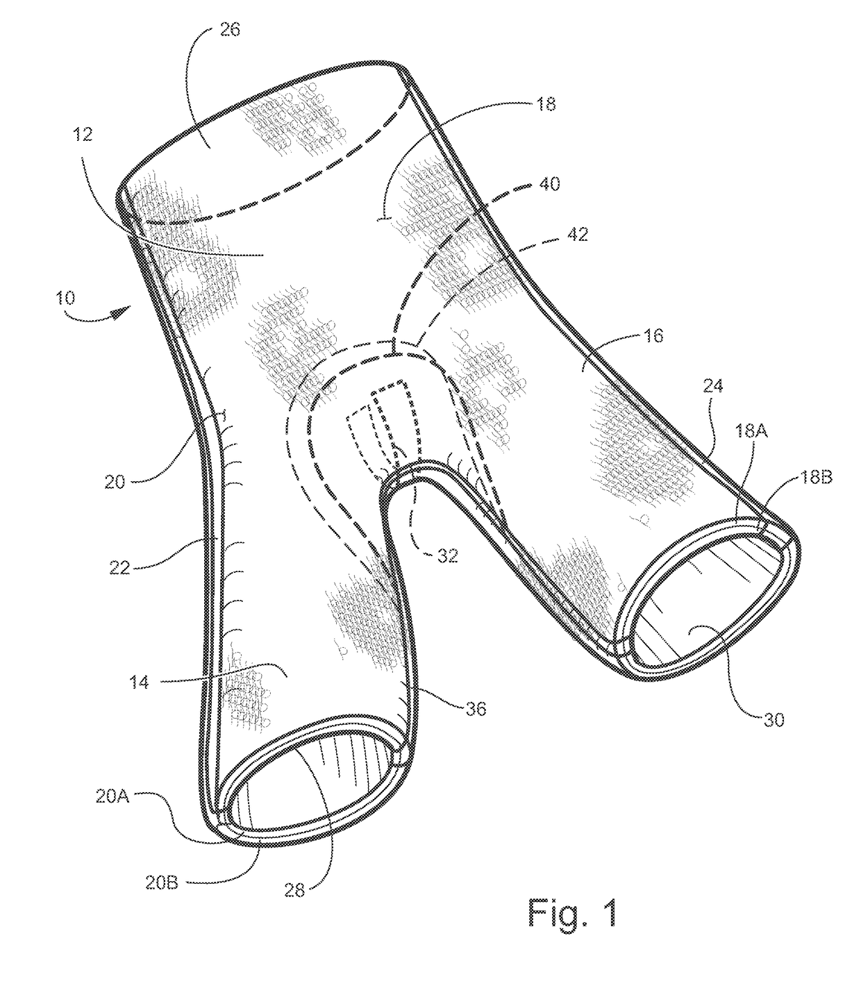 Hip spica cast and undergarment for use with hip spica cast