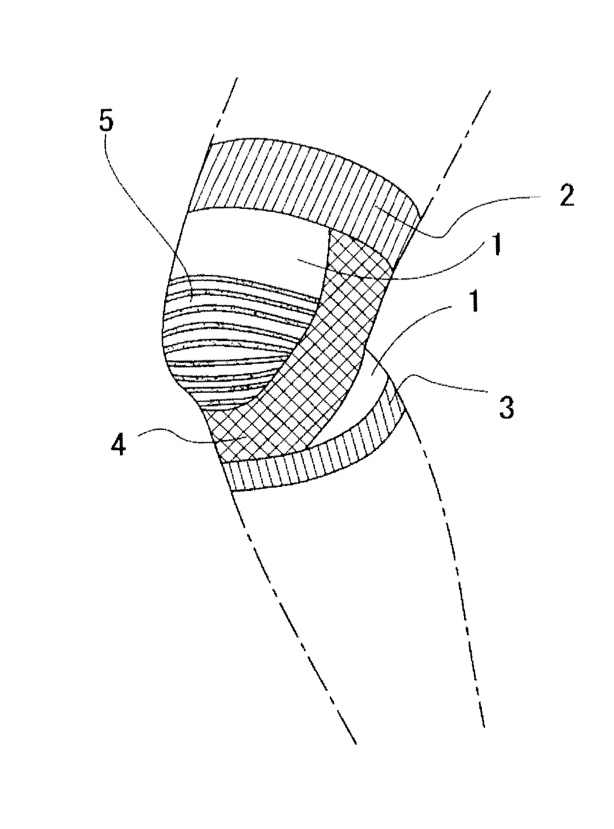 Knee Joint Supporter