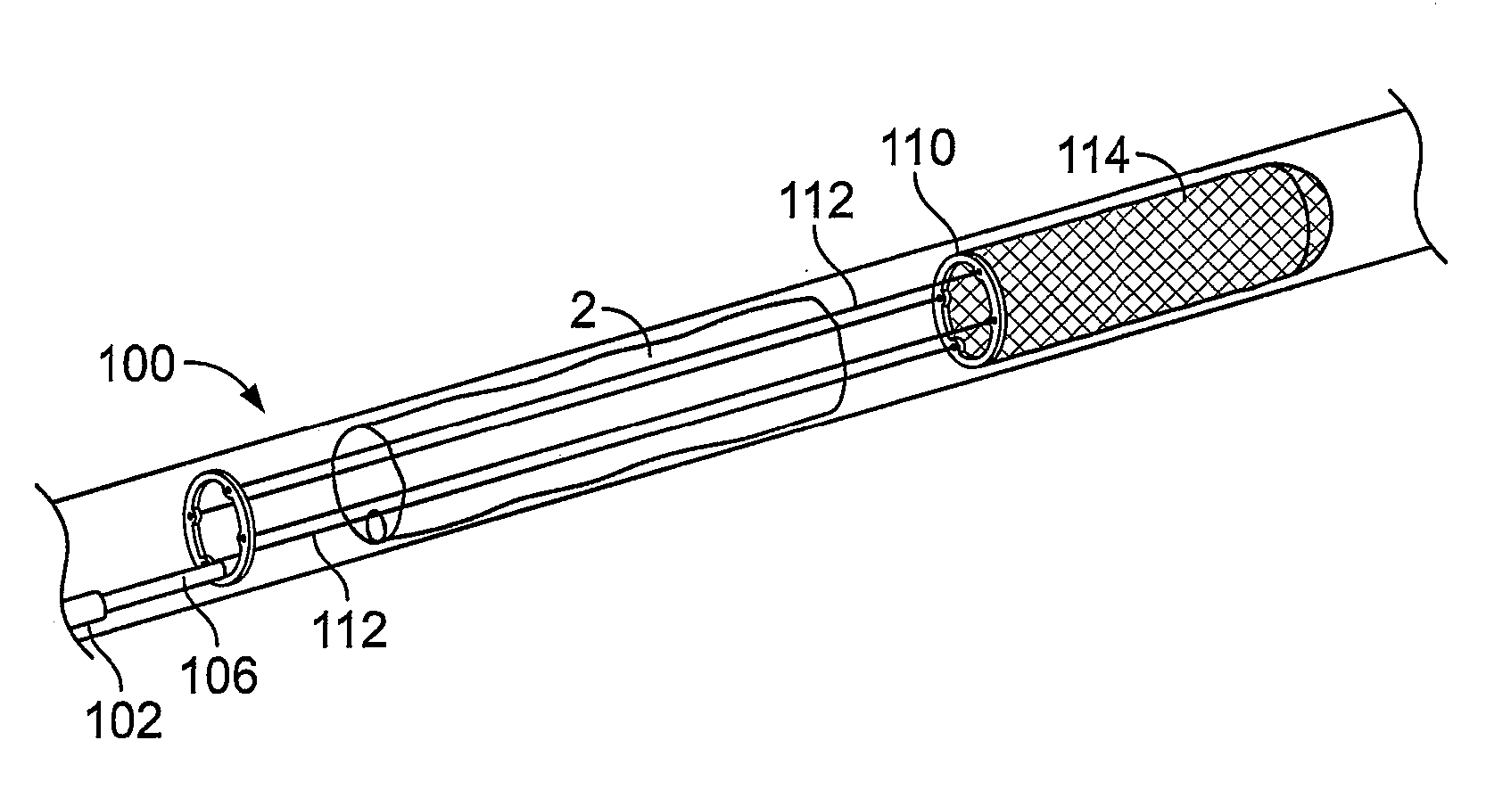 Devices for restoring blood flow within blocked vasculature