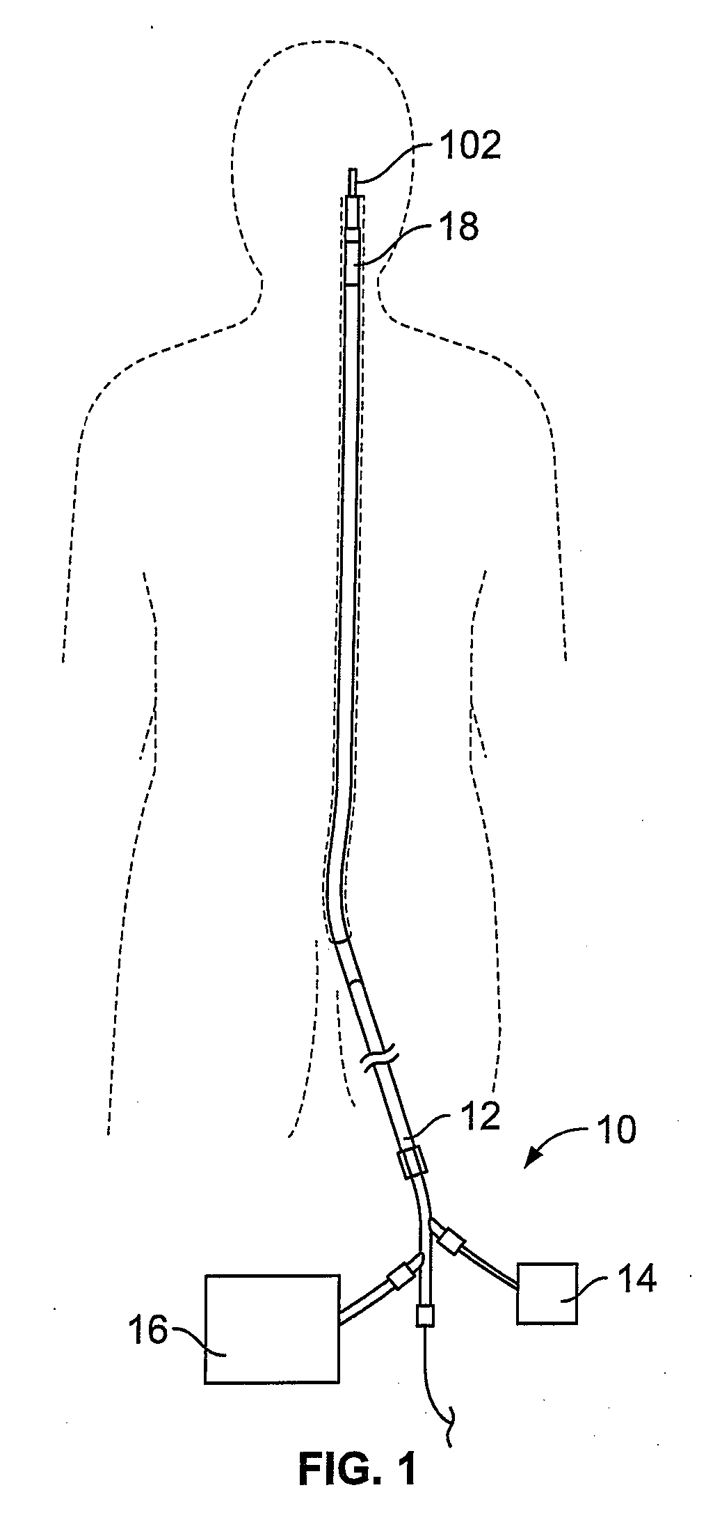 Devices for restoring blood flow within blocked vasculature