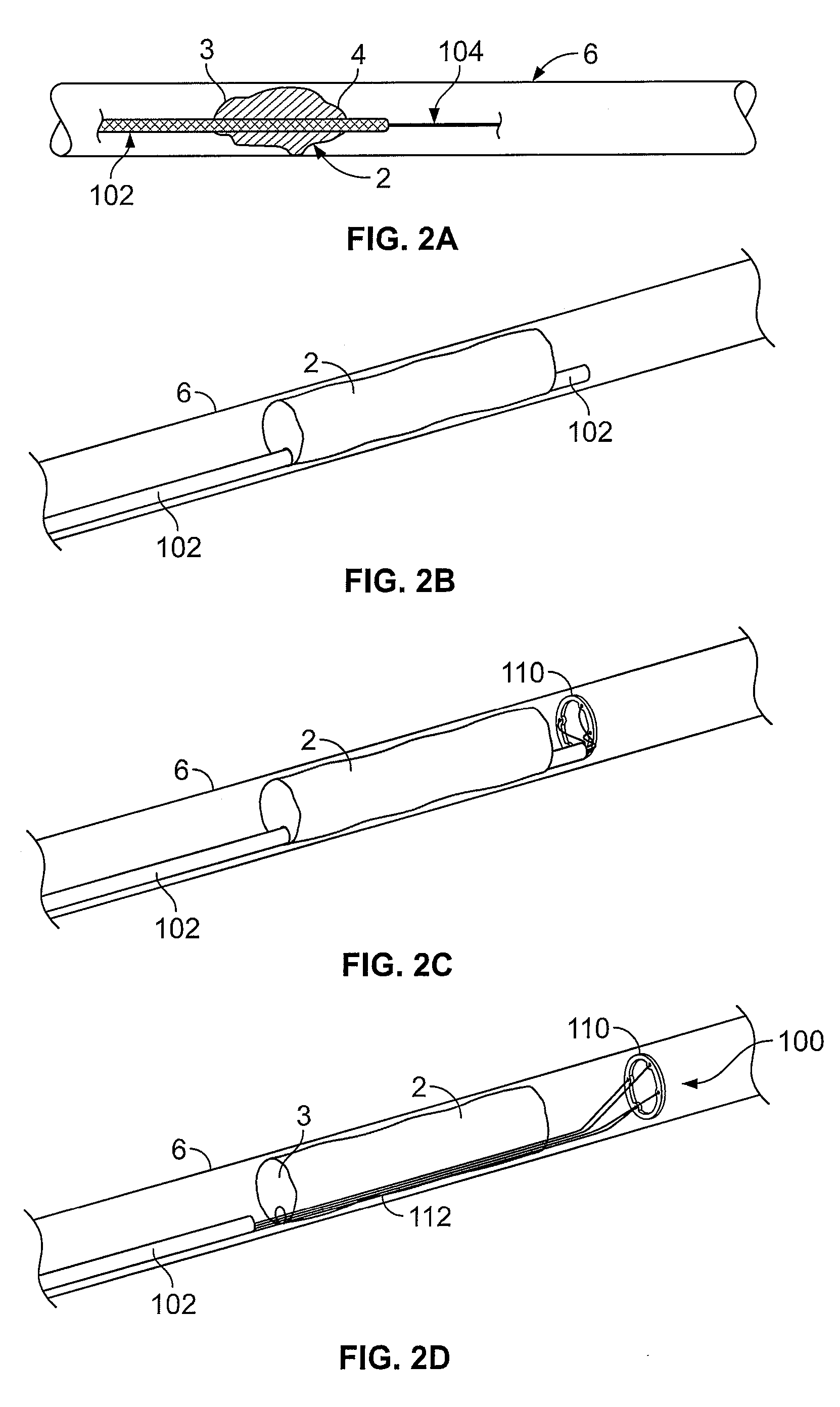 Devices for restoring blood flow within blocked vasculature