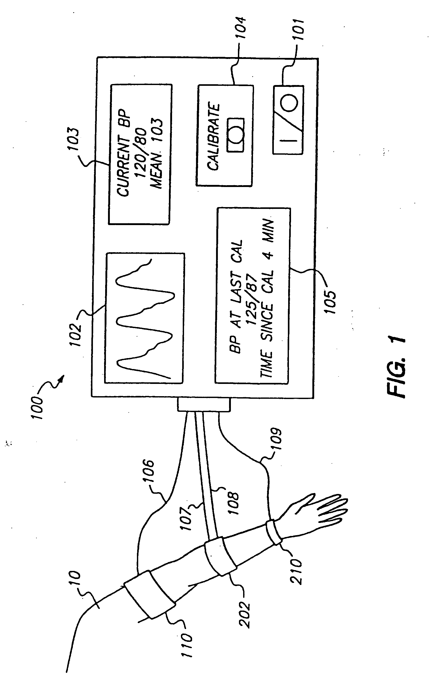 System and method of determining whether to recalibrate a blood pressure monitor