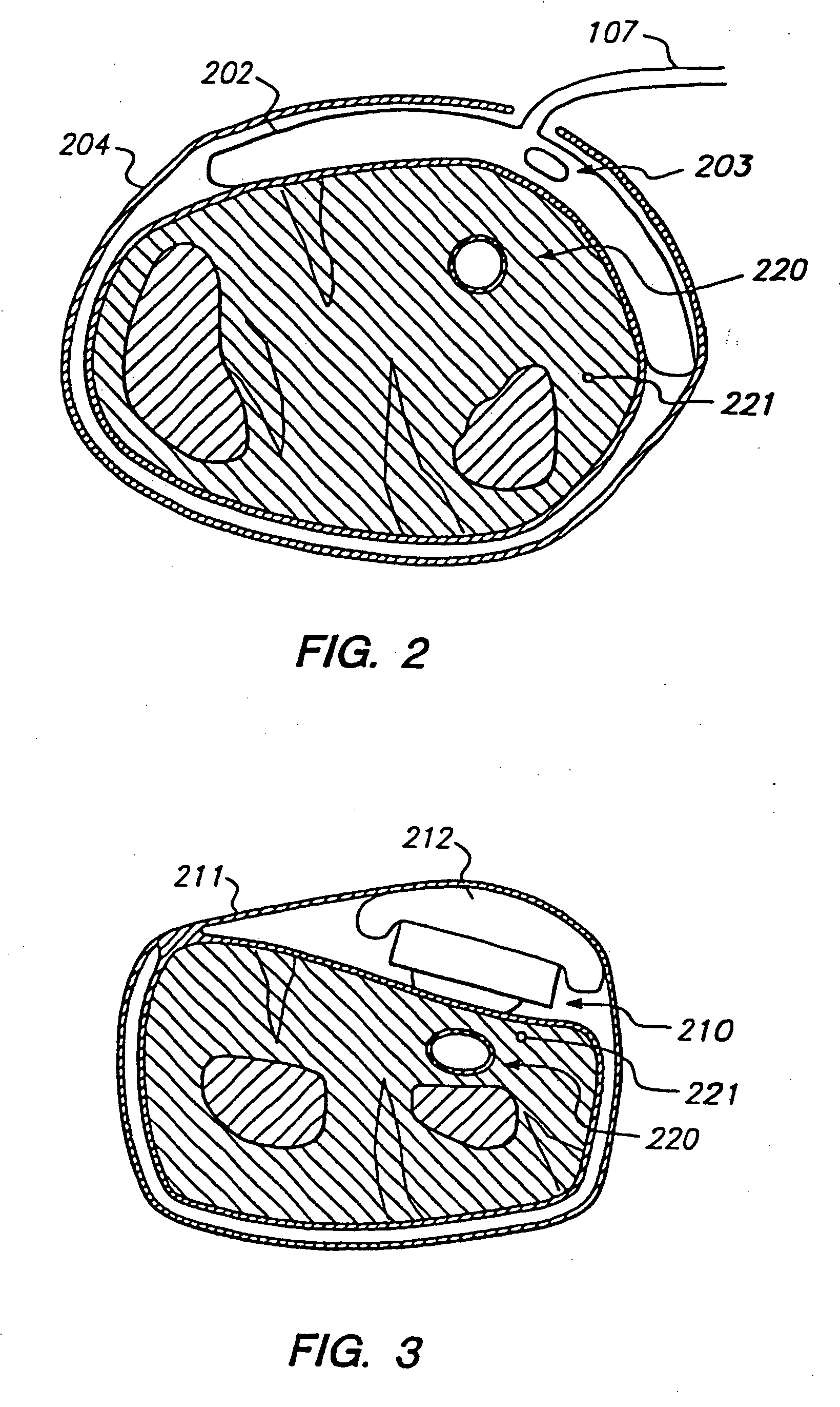 System and method of determining whether to recalibrate a blood pressure monitor