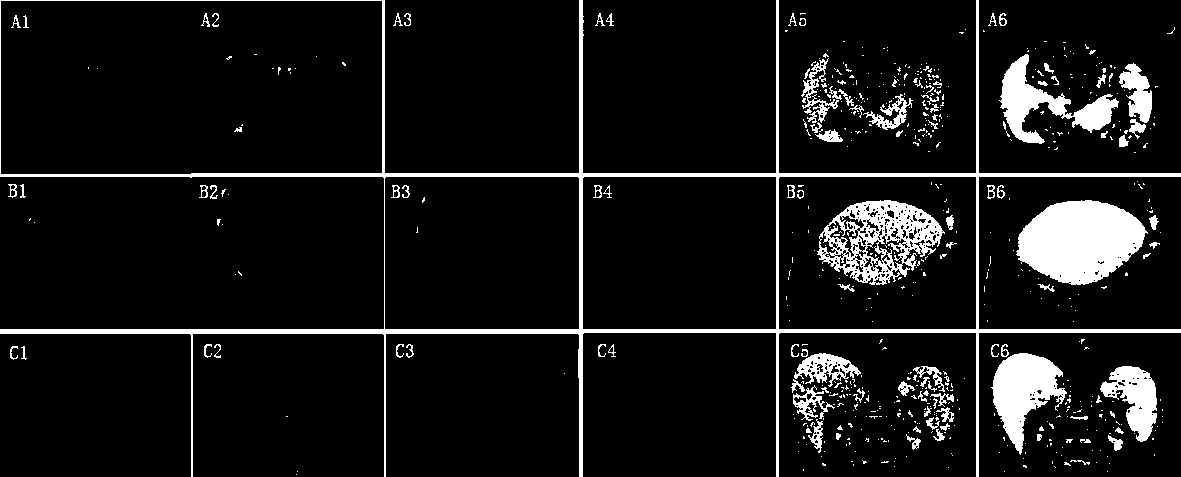 Method for setting initial position and posture of liver statistical shape model