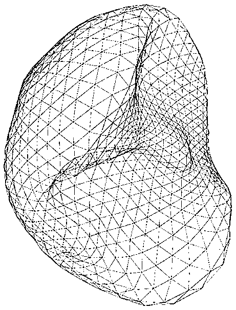 Method for setting initial position and posture of liver statistical shape model