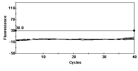 Various important aquagenic zoonoses protozoa simultaneous assay kit and preparation method thereof