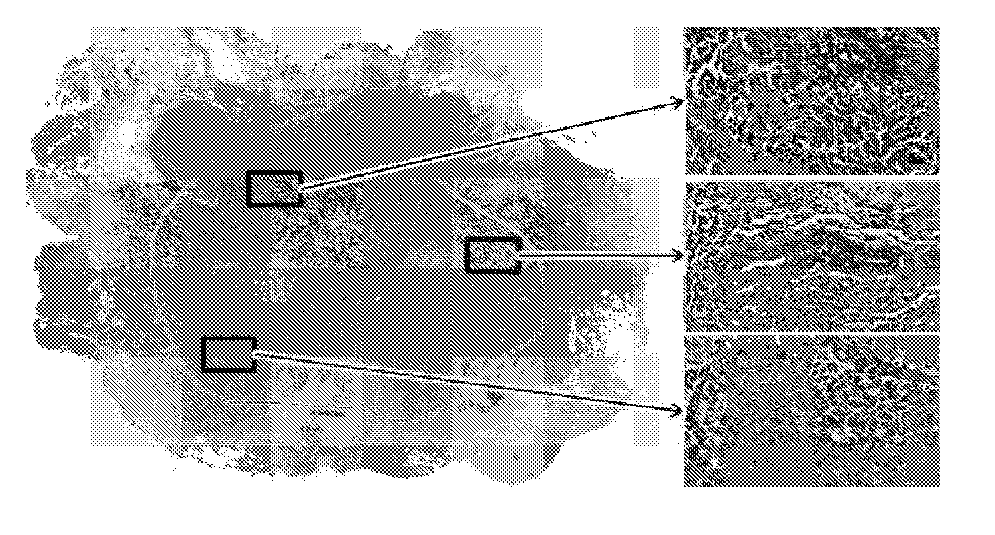 Boosted consensus classifier for large images using fields of view of various sizes