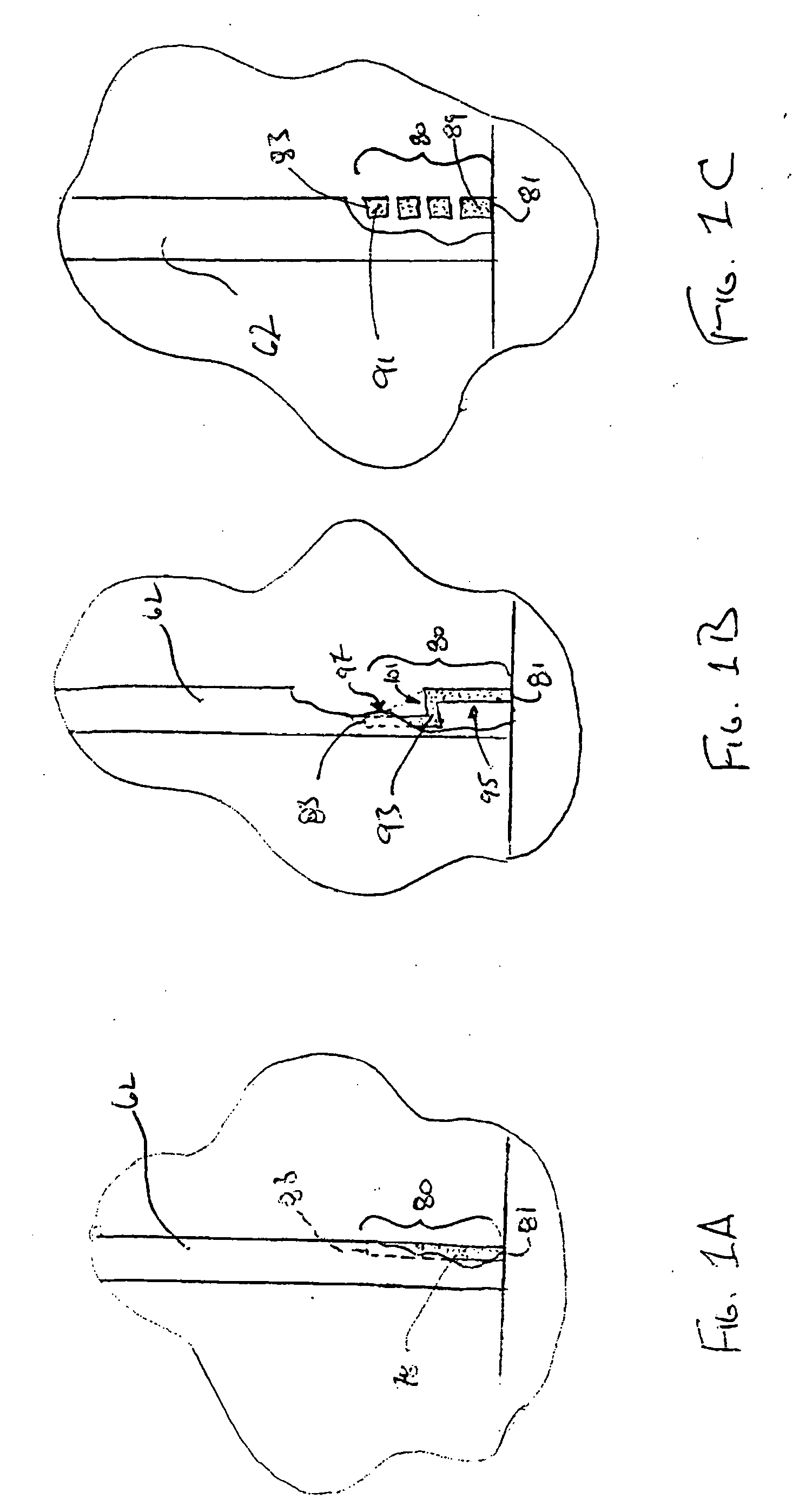 Absorbent article including barrier leg cuff structure and absorbent core with superabsorbent material