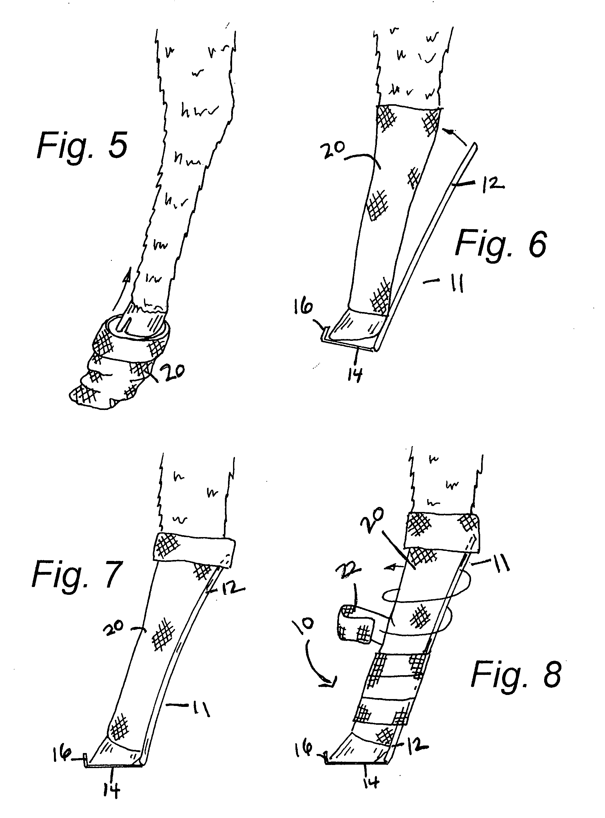 Leg splint