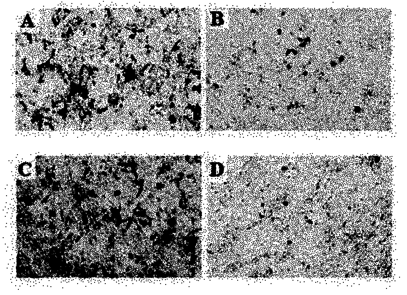 Gene treatment medicament capable of inhabiting immunoreaction caused by transgenosis products and preparation method thereof