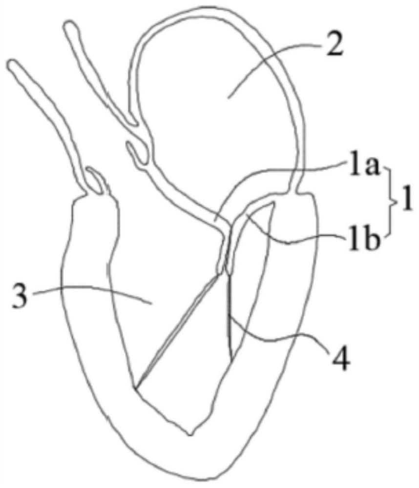 Valve clamping device with locking mechanism and valve repair system