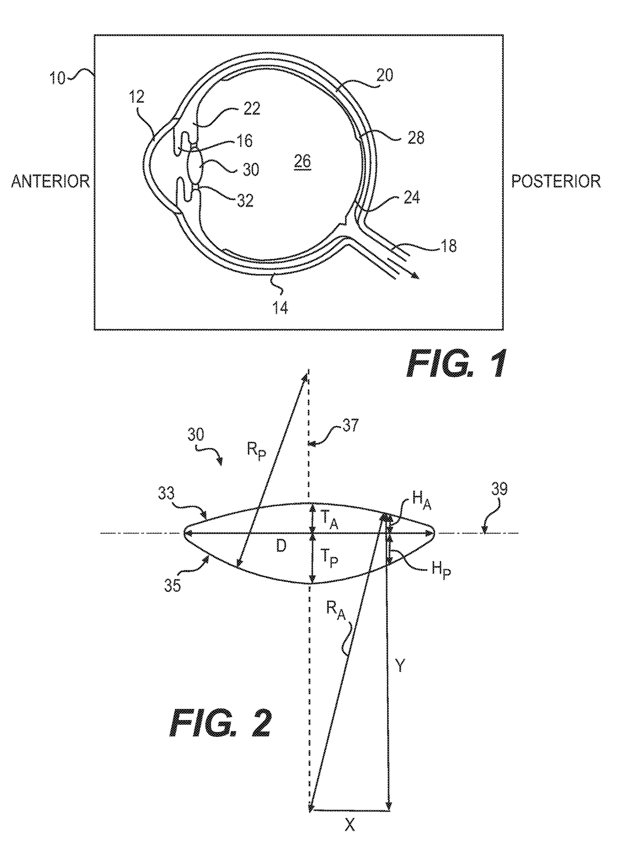 Intraocular lens designs for improved stability