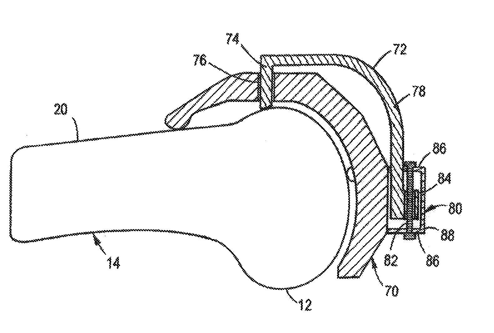 Device for positioning a bone cutting guide