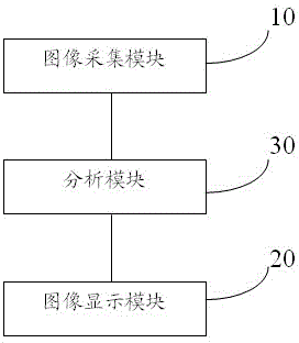 Movable type blood vessel navigation system