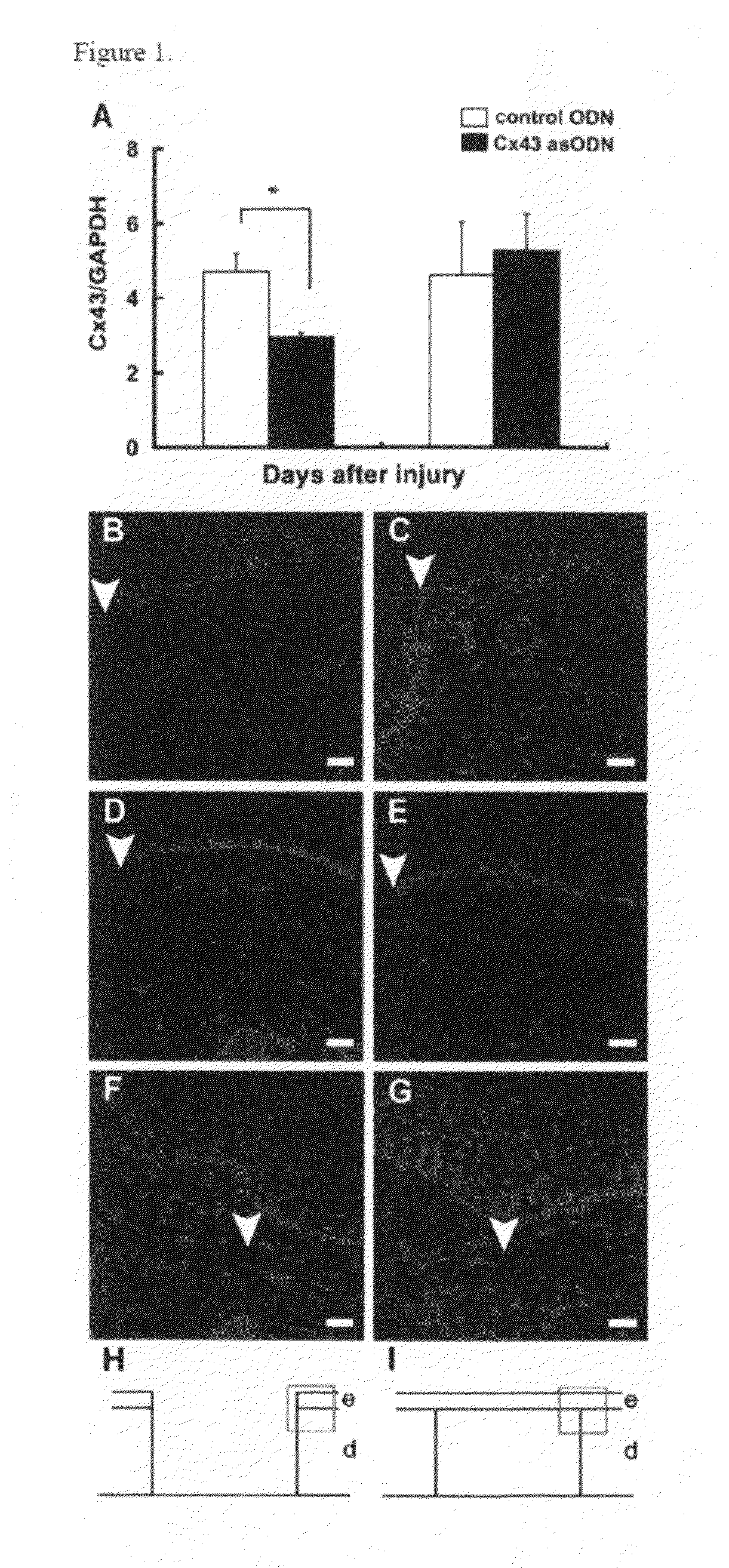 Methods and compositions for wound healing