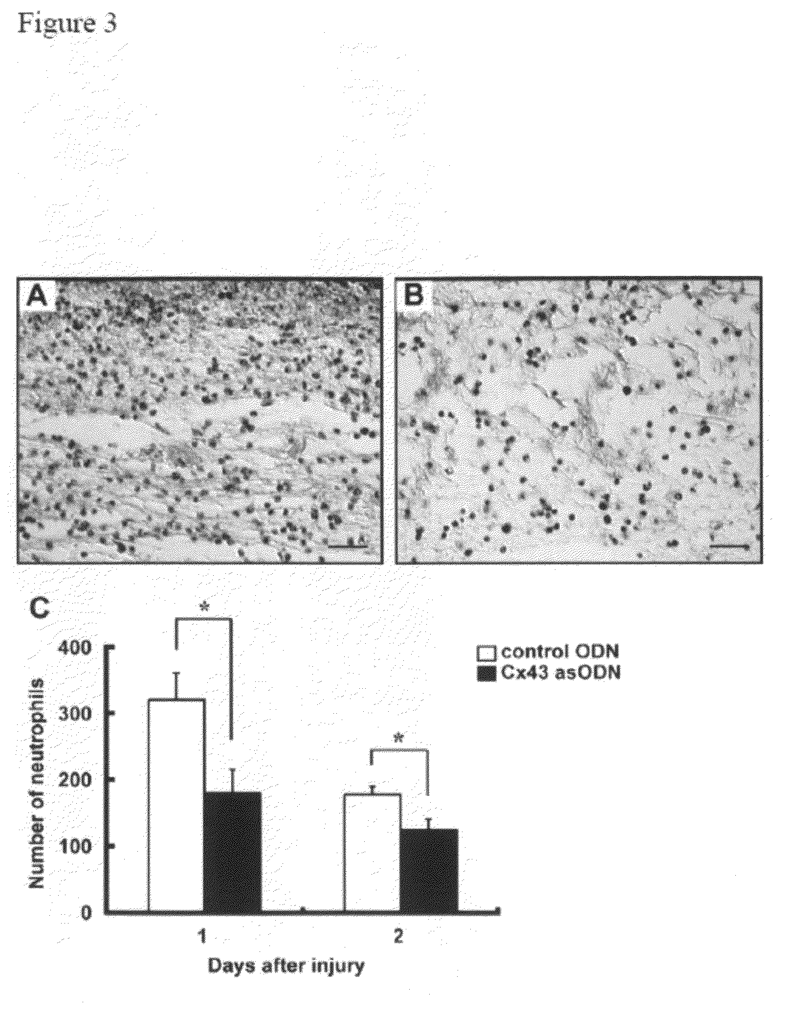 Methods and compositions for wound healing