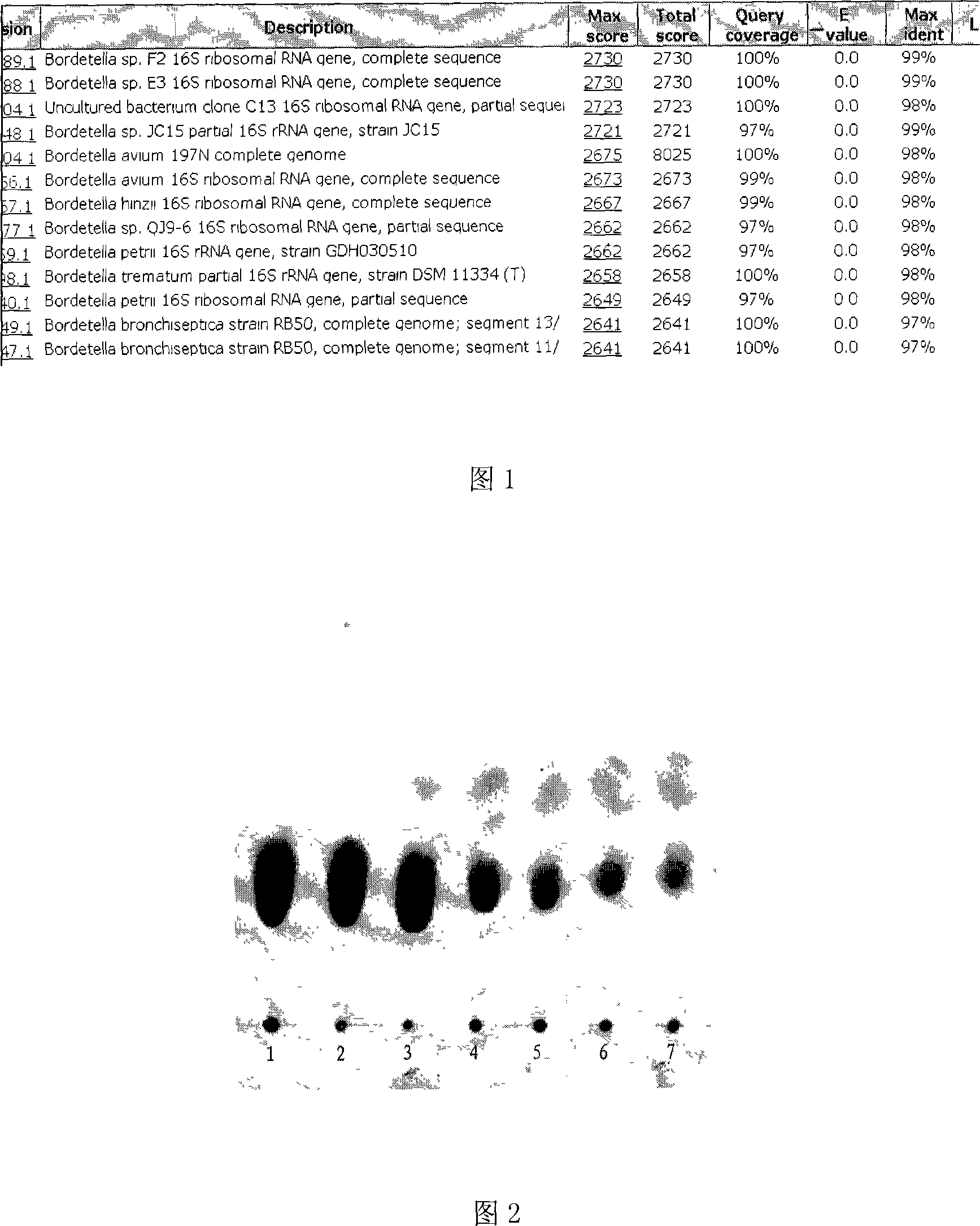 Bordetellasp and uses for preparations of cholesterol oxidase and cholest-4-en-3-ol thereof