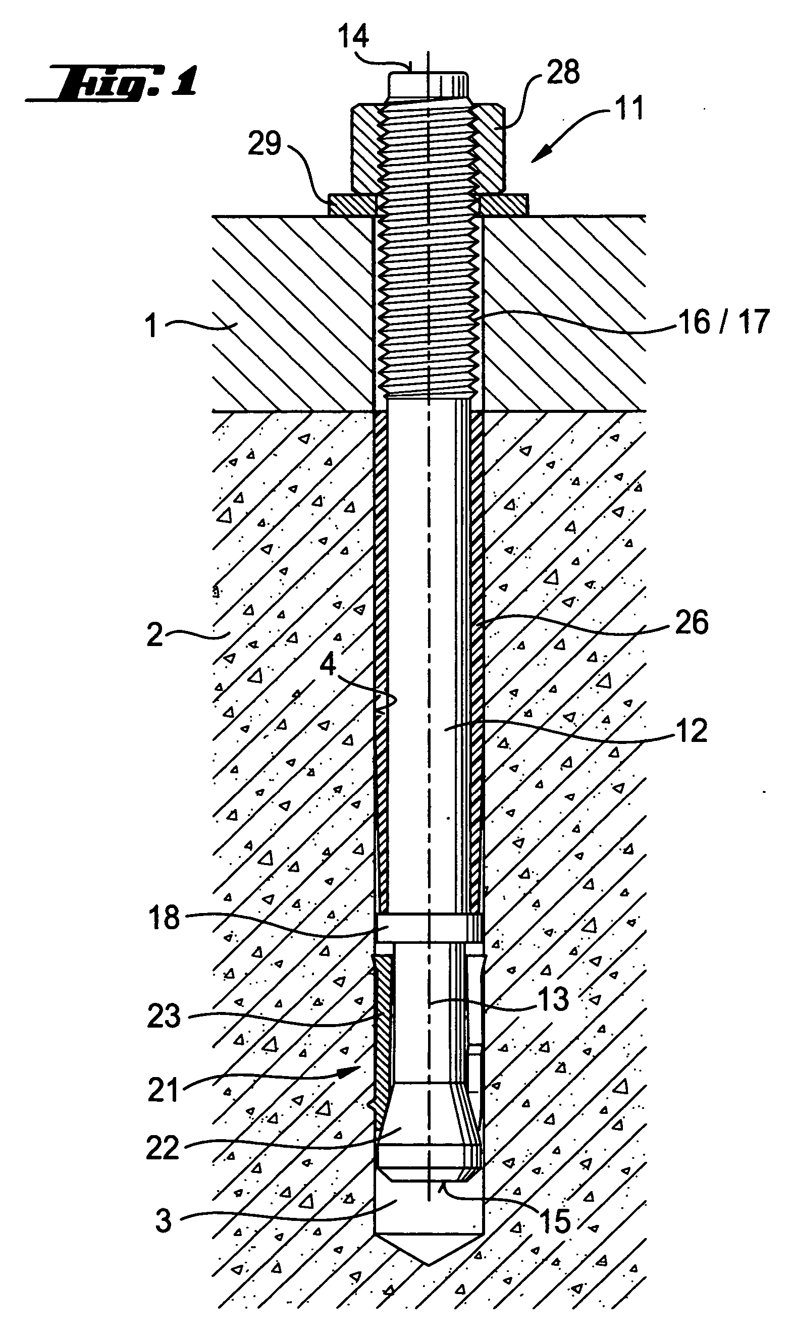 Expansion anchor