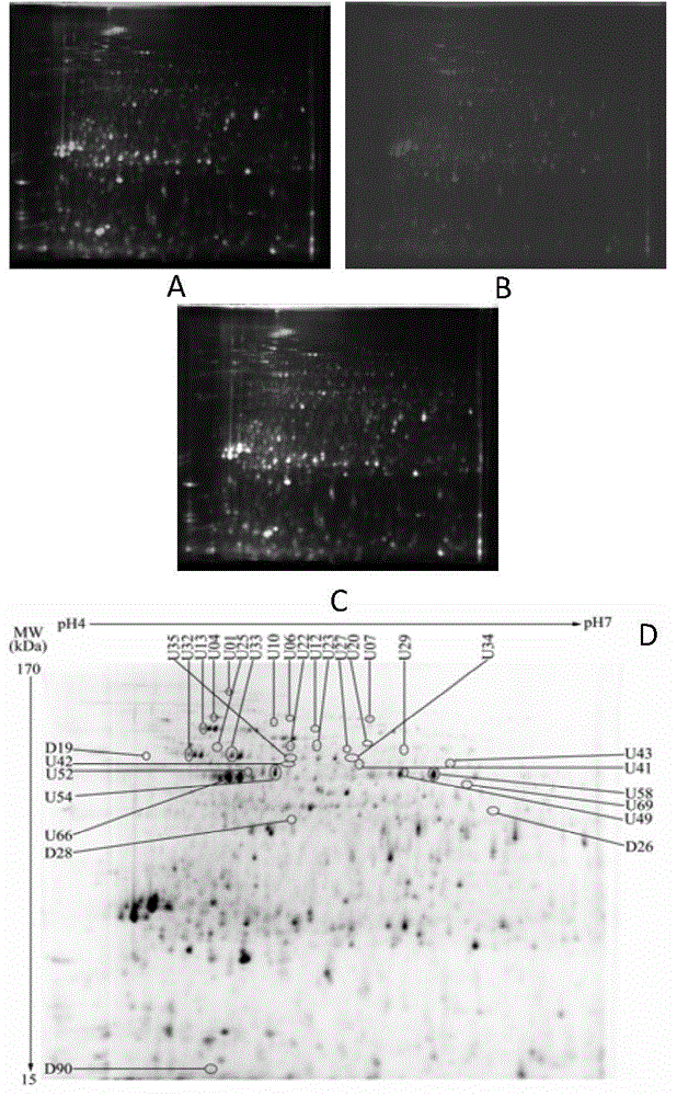 Method for screening control enzyme of microalgae adipopexis