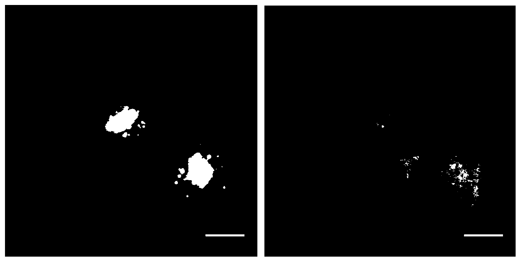 Total internal reflection illumination and semi-total internal reflection illumination dual optical path fluorescence microscope system