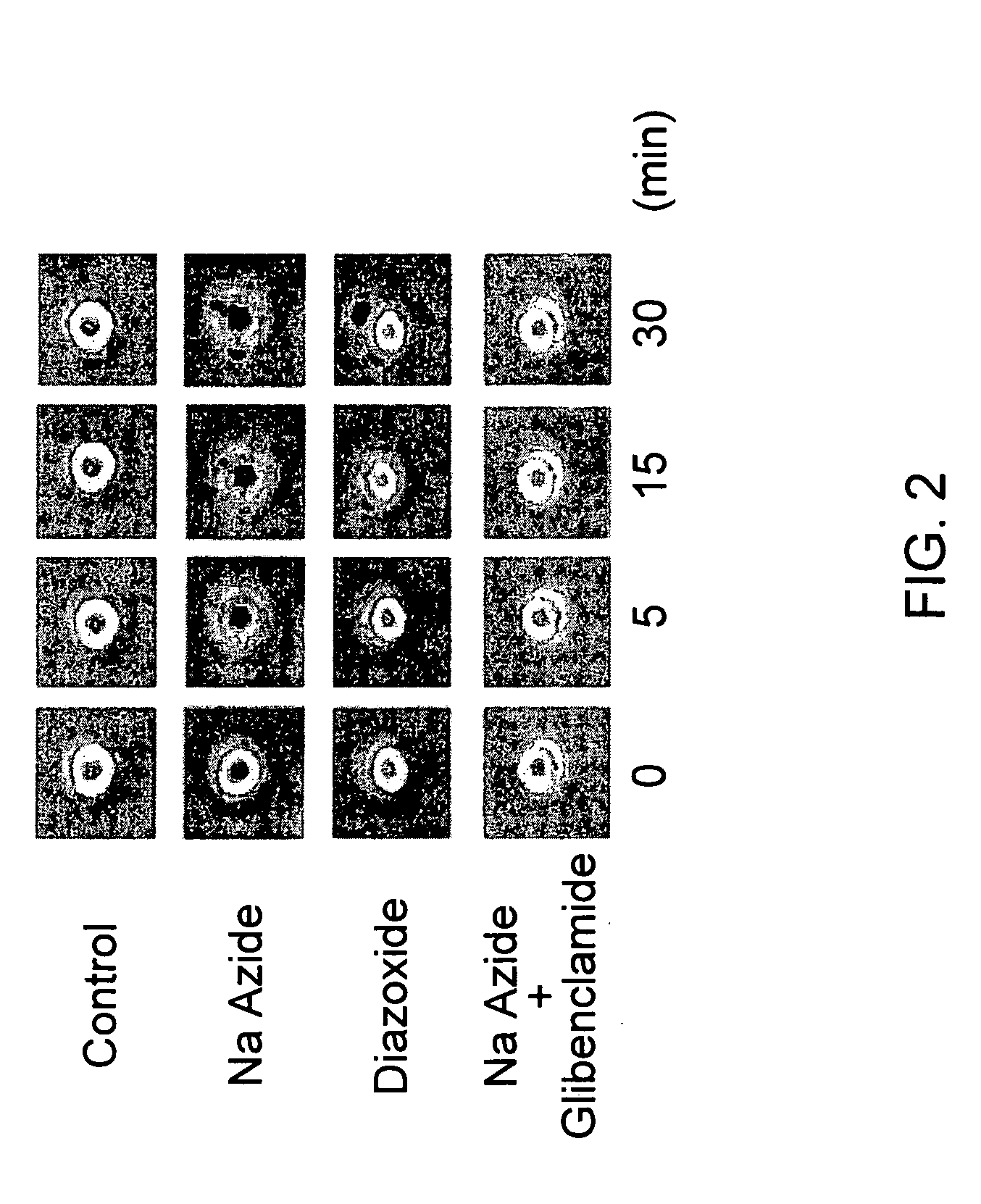 Therapeutic agents targeting the NCCa-ATP channel and methods of use thereof