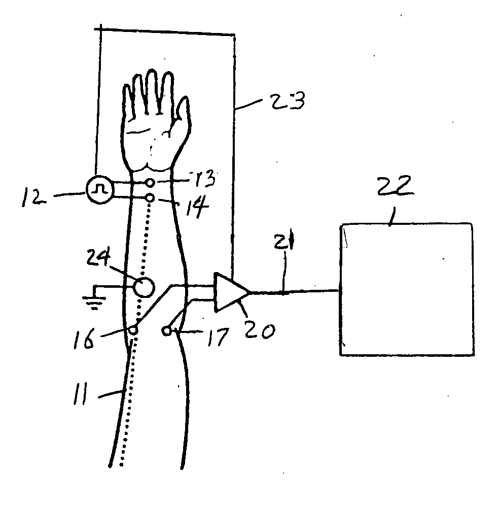 Method and apparatus for stimulus artifact suppression