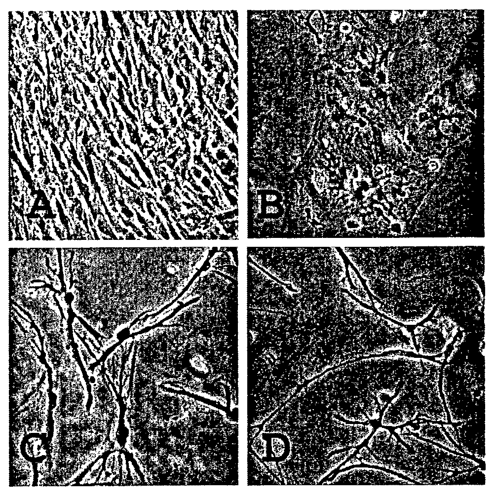 Trans-differentiation and re-differentiation of somatic cells and production of cells for cell therapies