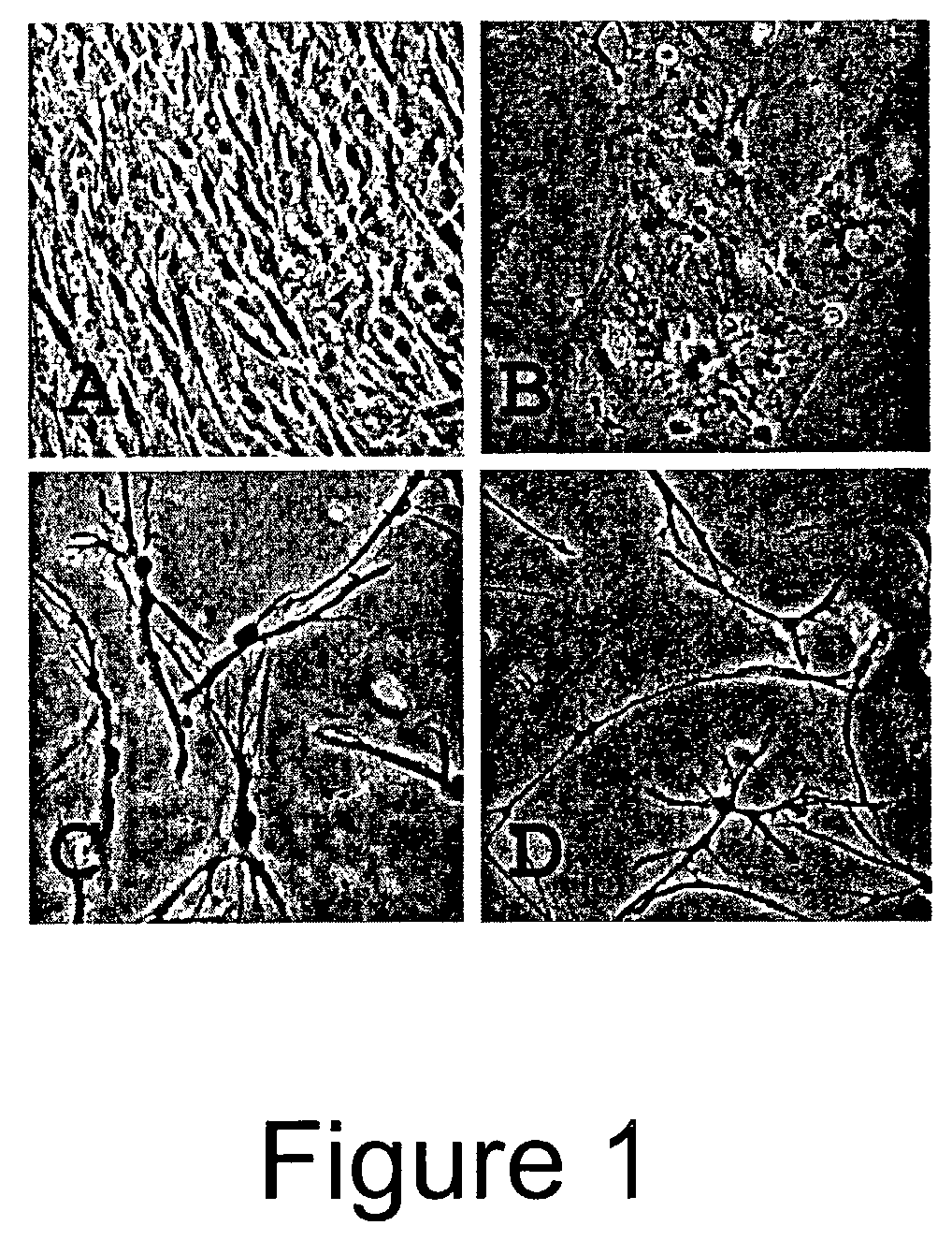 Trans-differentiation and re-differentiation of somatic cells and production of cells for cell therapies