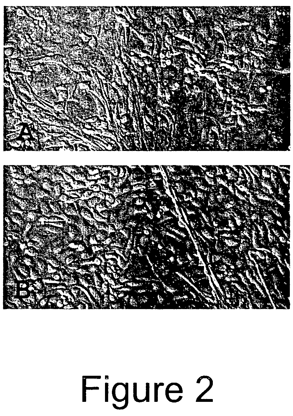 Trans-differentiation and re-differentiation of somatic cells and production of cells for cell therapies