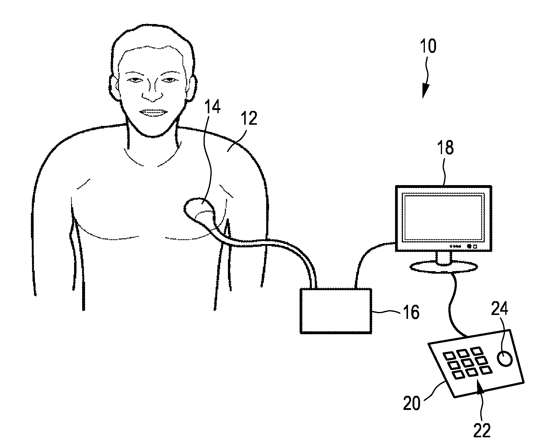 Large volume three-dimensional ultrsaound imaging