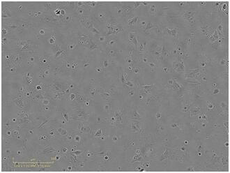 cd29  <sup>+</sup> Human umbilical cord-derived mesenchymal stem cells and their use in the preparation of drugs for the treatment of skeletal muscle atrophy in high-sugar and high-fat environments