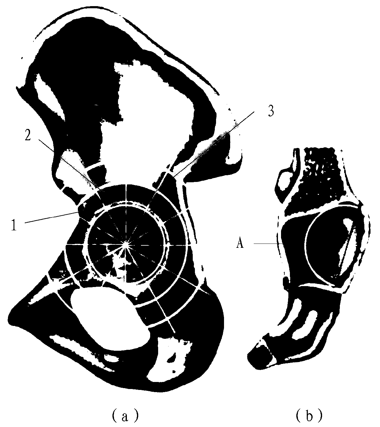 Acetabulum bone defect assessment method and device, storage medium and processor